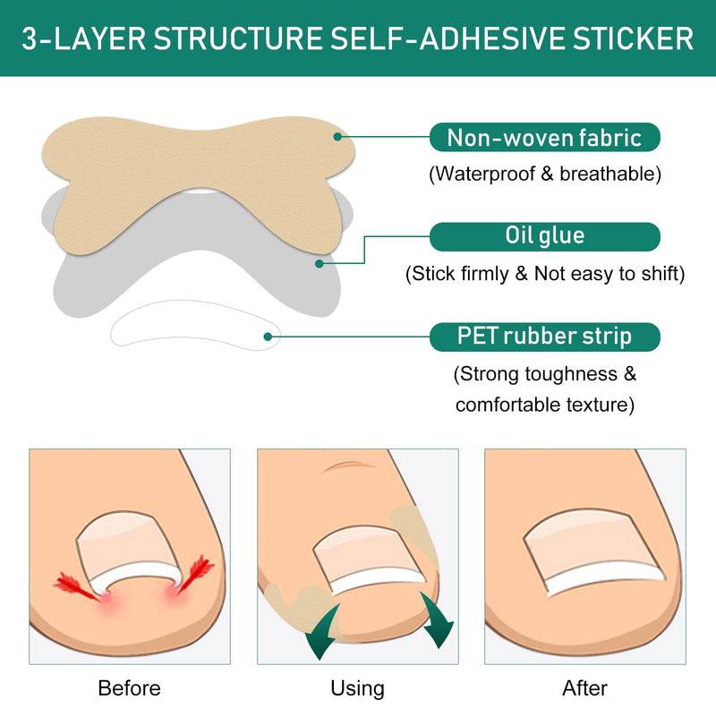 Nail Care Patches, Gentle Adhesive Design, Invisible Comfort, Easy to Apply, Breathable Material, Suitable for Daily Toenail & Fingernails