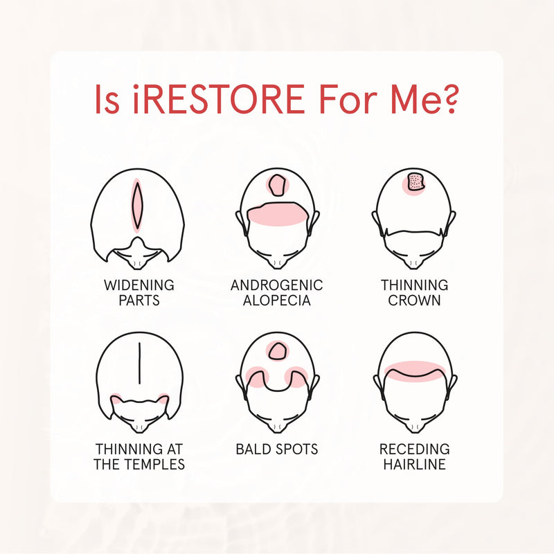iRestore Anti Hair Loss and Thinning Shampoo - Biotin Formula for Hair Growth, Thickening and Volumizing for Men & Women Fresh 8 Fl Oz (Pack of 1)