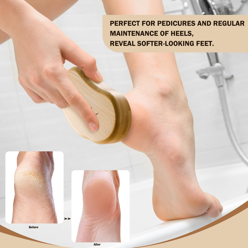 [Australia] - FVION Nano Glass Callus Remover, Callus Removal Foot, Callus Removal Wet & Dry, Professional Callus File Foot Care, Highly Effective Callus Rasp Velvety Soft Feet Yellow 