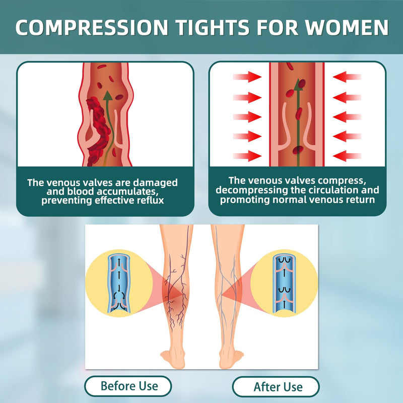 [Australia] - 2 Pairs 20-30mmHg Compression Pantyhose for Women, Medical Graduated Compression Stockings Leggings Footless Support Compression Tights for Varicose Veins, Swelling, Edema Large Footless/Black+Beige 