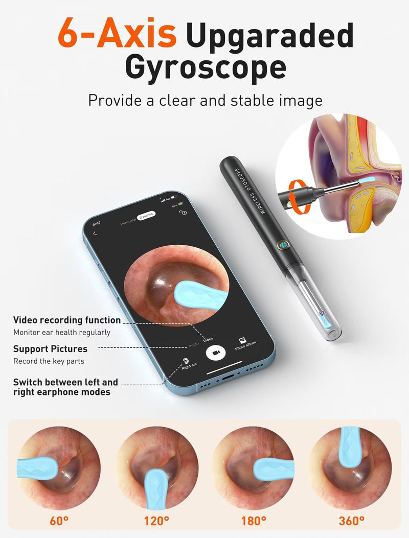 [Australia] - Ear Wax Removal Tool Camera - Ear Cleaner with 1080P HD Camera, FSA - HSA Store Eligible, Otoscope with Light, Earwax Removal Kit with 50 Replacement Tips for iPhone, iPad, Android Phones (Black) Black 