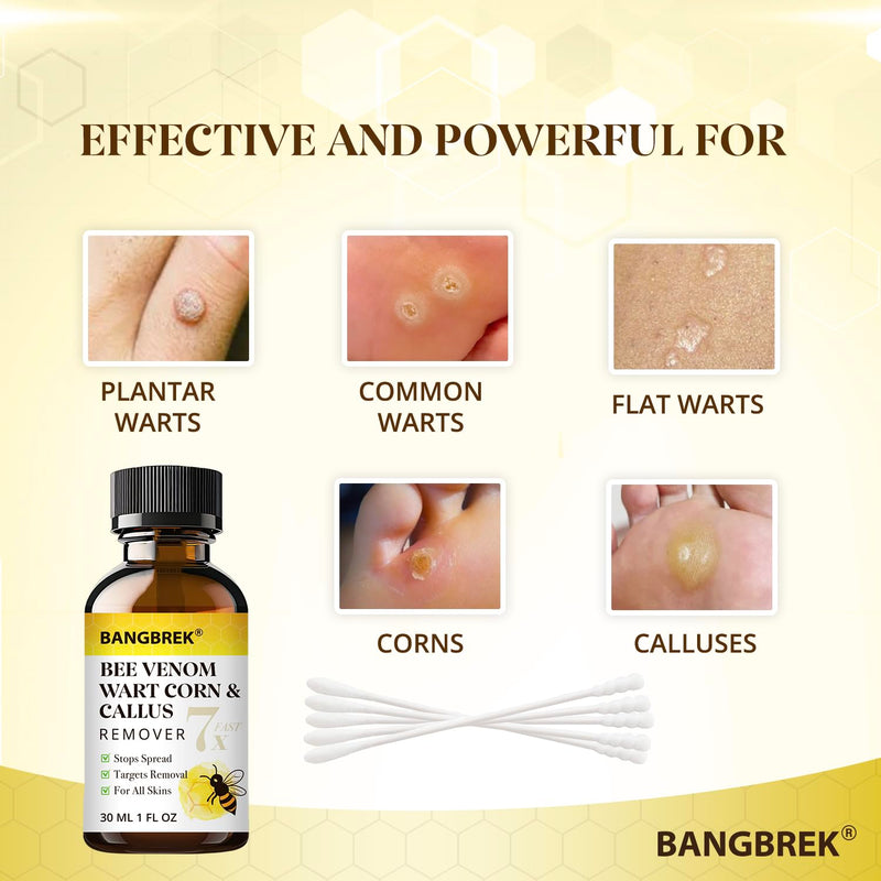 [Australia] - Bee Venom Wart Remover: 7x Fast Acting Wart Remover Freeze Off for Plantar Common Flat Wart Corn Callus Removers for Toes Feet - Maximum Strength Salicylic Acid Wart Corn Callus Removers (1 Fl Oz) 1 Fl Oz (Pack of 1) 