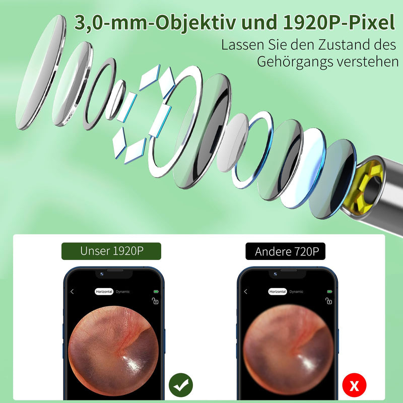 [Australia] - Earwax Remover Otoscope, VITCOCO 1920P Wifi Ear Cleaner, Ear Cleaner with Camera, Otoscope with 6 LEDs for iPhone, iPad and Android Smartphones, Black 