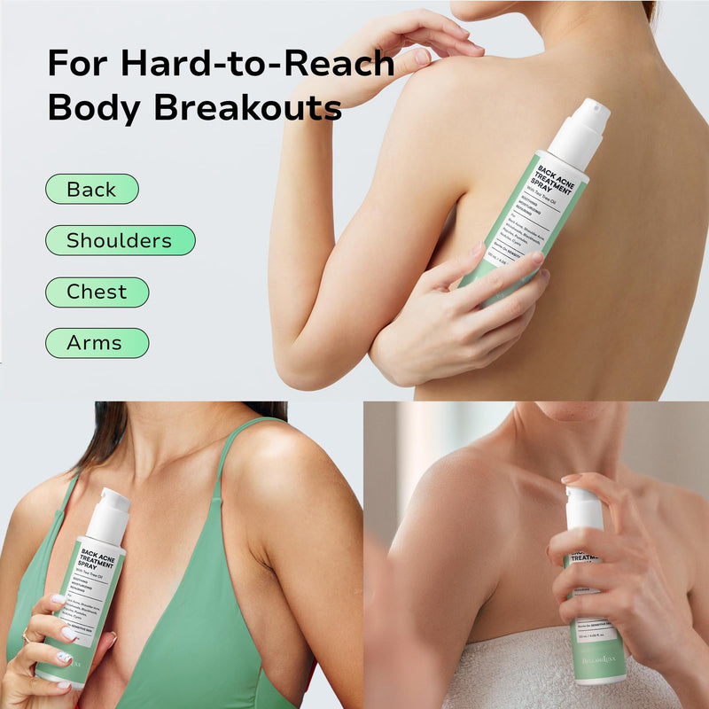 [Australia] - Back and Body Acne Treatment Spray: 2% Salicylic Acid & Tea Tree Oil Bacne Spray for Clear, Soothe & Moisturize - Effective for Men, Women, Teens with Back, Shoulder, Arm, and Chest Acne 4.06 Fl Oz (Pack of 1) 
