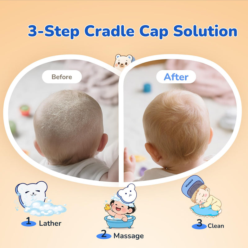 [Australia] - Cloud Baby Cradle Cap Brush Kit, 3-in-1 Cradle Cap Treatment Set with Soft Brush, Curved Comb & Sponge, BPA-Free, Easy to Use | Baby Bath Essentials - Extra Sponge, Serene Green 