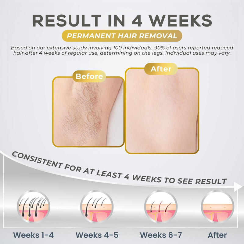 [Australia] - IPL Hair Removal Device for Women and Men, Home Use for Face, Legs, Arms, Bikini Line, Whole Body Treatment With 5 Gear Level, Pulsed Light Technology, Unlimited Flashes 