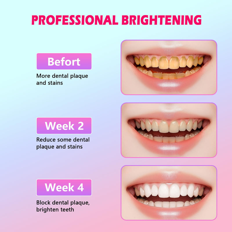 [Australia] - Niacinamide Whitening Toothpaste, Niacinamide Intense Whitening Toothpaste, Gently Removes Stains, Improves Oral Health, Freshens Breath 24 Hours 3.53 Ounce (Pack of 1) 3.53 Ounce (Pack of 1) 