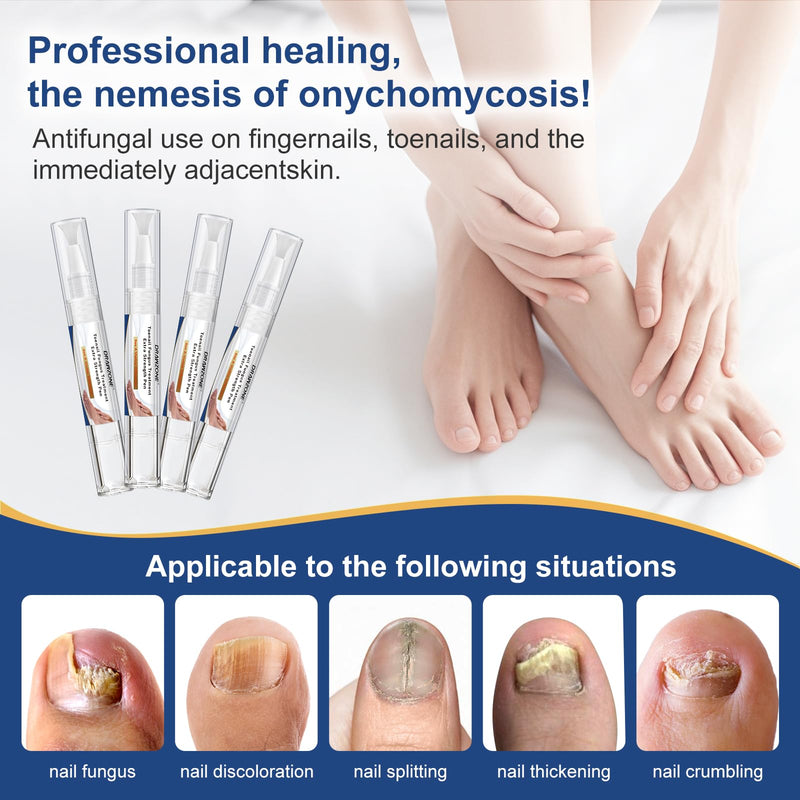 Toenail Fungi Treatment Extra Strength - Fungi Nail Pen, 25% Undecylenic Acid, Ingrown toenail treatment, Fungus nail treatment, yellow toenail, Damaged Nails foot fungus treatment extra strength 0.17 Fl Oz (Pack of 4) 4pcs