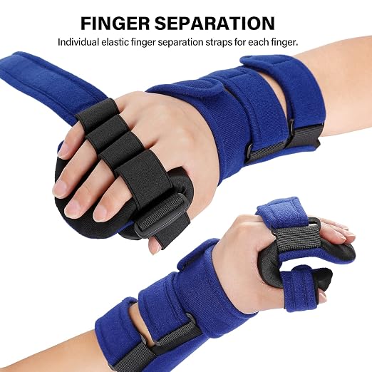 Resting Hand Splint, Functional Hand Brace, Wrist & Finger Night Immobilizer, Hand Support for Tendinitis, Arthritis, Carpal Tunnel Syndrome, Stroke Hand, Fit for Left and Right Hand L/XL