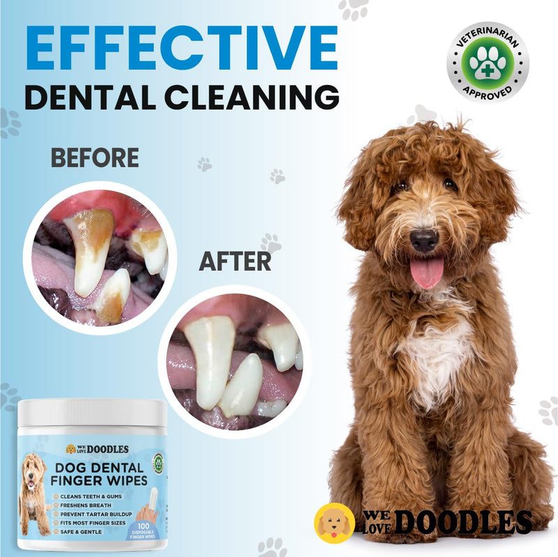 We Love Doodles Dog Teeth Cleaning Wipes - Pet Dental Finger Wipes for Dogs - Cleans Teeth and Gums, Freshens Breath Dog Dental Wipes, Prevents Tartar Buildup, Fits Most Finger Sizes - 100 PCS 100 Wipes - PawsPlanet Australia