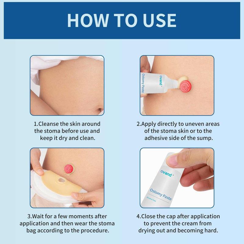 [Australia] - Ostomy Paste, Alcohol-Free Skin Barrier Ostomy Paste for Stoma filling to prevent leaks, Stoma Care Supplies Ostomy Supplies (2 box) 