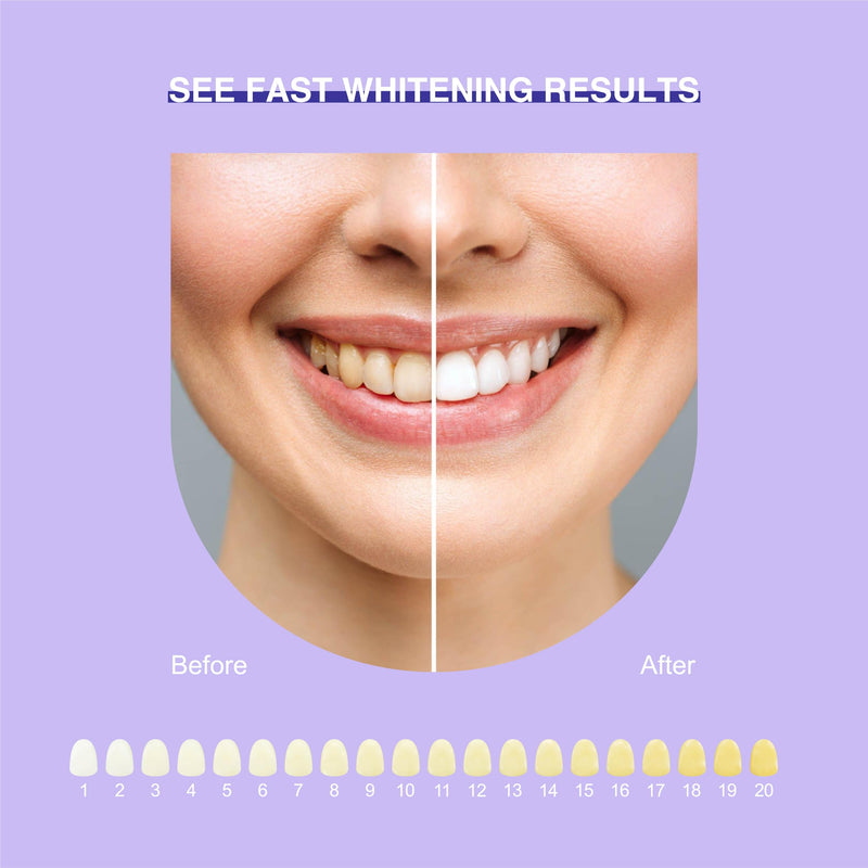 [Australia] - Teeth Whitening Kit with LED Light Pro Teeth Whitener Combo for Efficient Sensitive Teeth Whitening, 4 Teeth Whitening Gel Pens & 2 Mouth Trays 