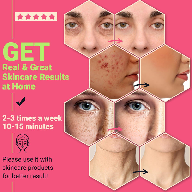 Acne Light Therapy Wand Red Light Therapy for Face - ROSIONG LED Facial Skin Red Blue Light Therapy Wand Device at Home