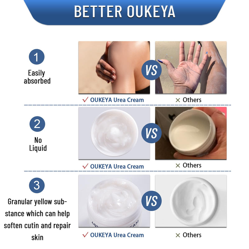 OUKEYA Urea Cream 40 Percent,Foot & Hand Cream for Dry Cracked,Urea Lotion for Feet Maximum Strength(2 Packs) 5.29Oz-2P