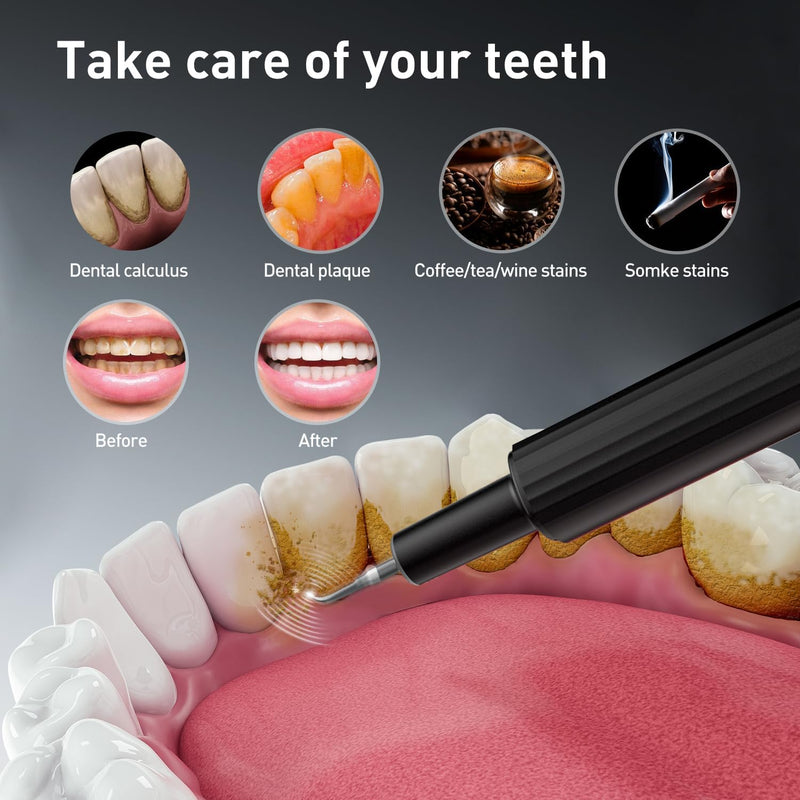 [Australia] - Plaque Remover for Teeth - Tartar Remover for Teeth, Dental Calculus Remover Teeth Cleaning Kit 4 Speed Modes with 4 Replaceable Heads, IPX6 Waterproof with LED Light 