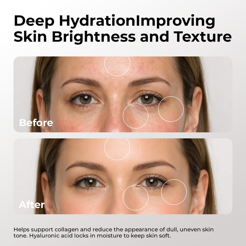 Skin Deva Vitamin C Face Serum, with Hyaluronic Acid, Matrixyl 3000, Anti Aging Serum, Anti Wrinkle Facial Serum - Improve Appearance of Dark Spots, Fine Lines, Glowing, Serum for Face (Pack Of 1) 1 Fl Oz (Pack of 1)
