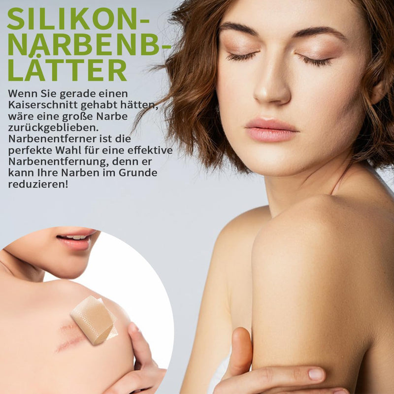 [Australia] - Scar plaster, silicone plaster for scars, silicone scar tape, reusable silicone scar plaster, medical scar treatment for all skin types, safe and effective (4 cm x 150 cm roll) colour 