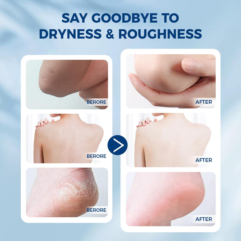 [Australia] - OUKEYA 42% plus Salicylic Acid 2% with 40 percent Urea Cream 40 percent Intensive Repair Treatment for Cracked Skin on Hands, Heels, Elbows, Relief for Dry FeetEnhanced Pump Dispenser Packaging 2 Pack 5.29 Ounce(40% Urea Cream&42%Urea Cream) 