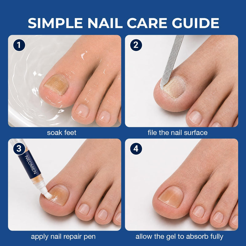 Nail Fungus Pen, Toenail Fungus Pen Treatment for Toenails & Fingernails, Daily Nail Appearance Care - 4 Count 4 pc