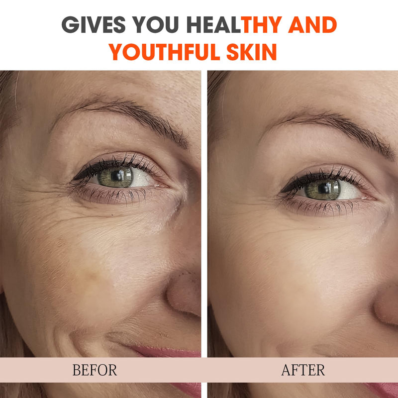 Super Vitamin C Serum for Women over 70, All-In-One Total Package Face Serum for Mature Skin, Hydrating, Lifting, Anti-Aging Reduce Wrinkles Age Spots Unscented
