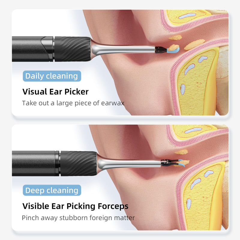 [Australia] - Earwax Remover, Electric Ear Cleaner Removal with LED Light, Ear Cleaning Camera Otoscope with Light Endoscope Camera for Adults and Children Pets Black Black 