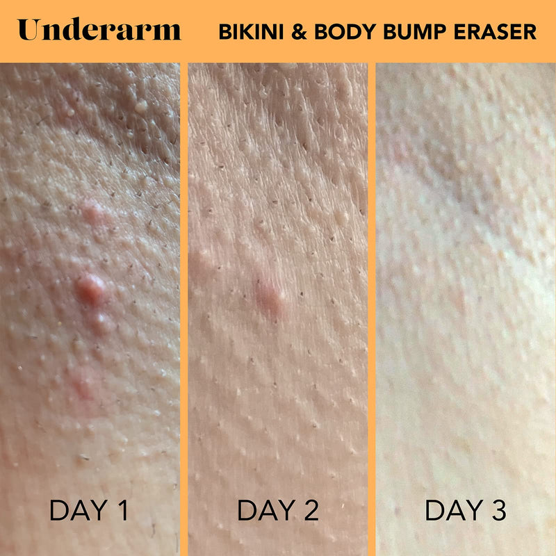 [Australia] - SweetSpot Labs Bikini & Body Bump Eraser | Treat Razor Bumps & Dark Spots | With Essential Ingredients Niacinamide & Bentonite Clay | 0.5 oz Bump Eraser (Pack of 1) 