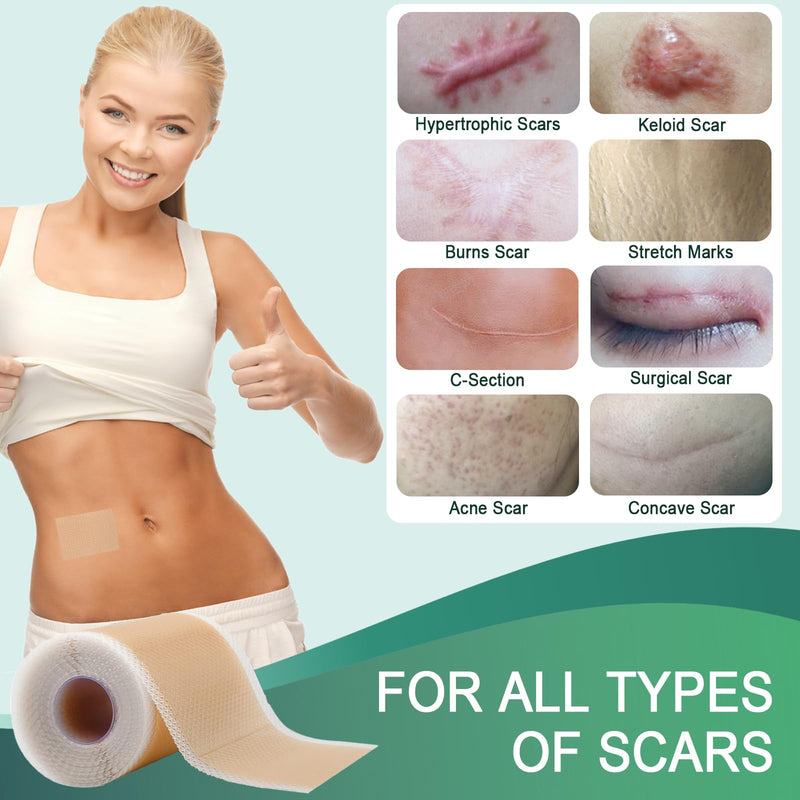 [Australia] - Silicone plaster for scars, professional scar plaster, reusable (4cm x 150cm) 4cm x 150cm 