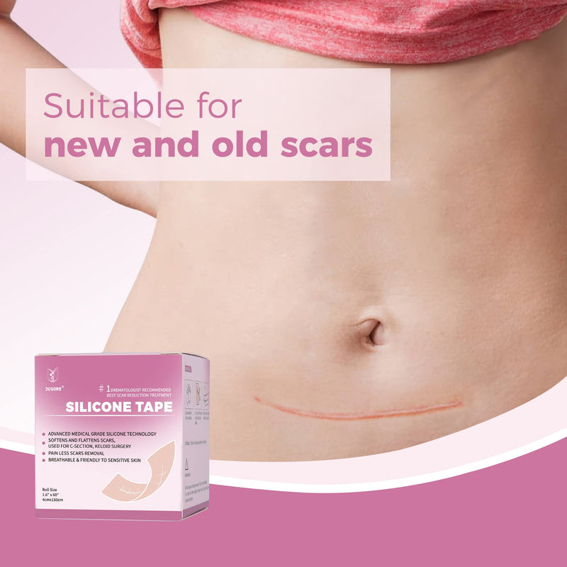 [Australia] - Silicone Scar Tape Scar Sheets - Professional Medical Grade Scar Removal Treatment, Non irritating, Painless for C-Section, Surgical Scars, Burn, Keloid, Acne(1.6” x 60” Roll) 4x150cm 