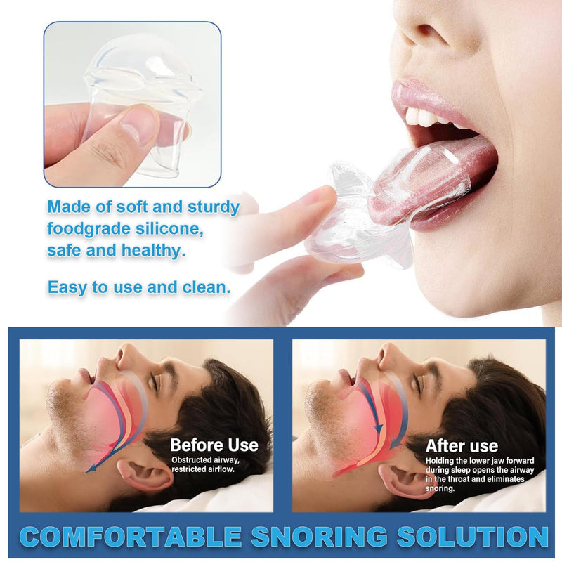 [Australia] - Snoring Solution - Anti-Snoring Device, Reusable Snore Solution Stopper for Men/Women-f18 White M 