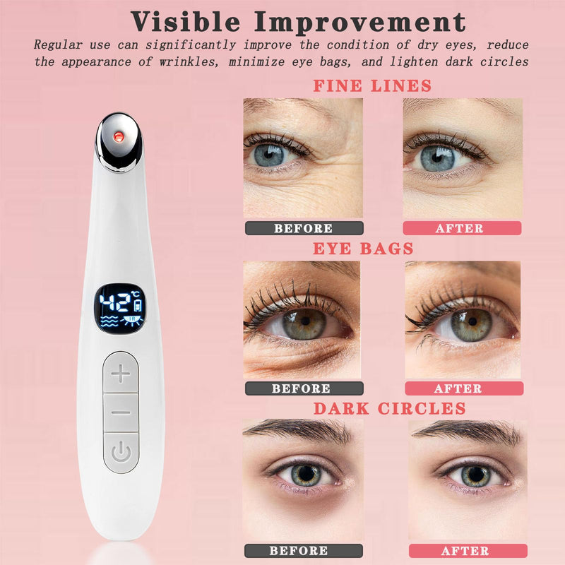 Eye Lift Wand, 3 in 1 Vibrating Red Light 98°F to 113°F LCD Display Eye Massager for Dry Eyes, Dark Circles and Puffiness, Electrical Face, Neck Sculpting Pen for Fine Lines and Wrinkles White