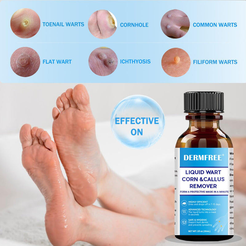 [Australia] - LIGUID WART Remover,Fast Action Wart Remover,Wart Liquid with Salicylic Acid, Plantar Wart, Common Wart, Flat Wart,Corn, Callus,1floz(30mL) 1 bottle 