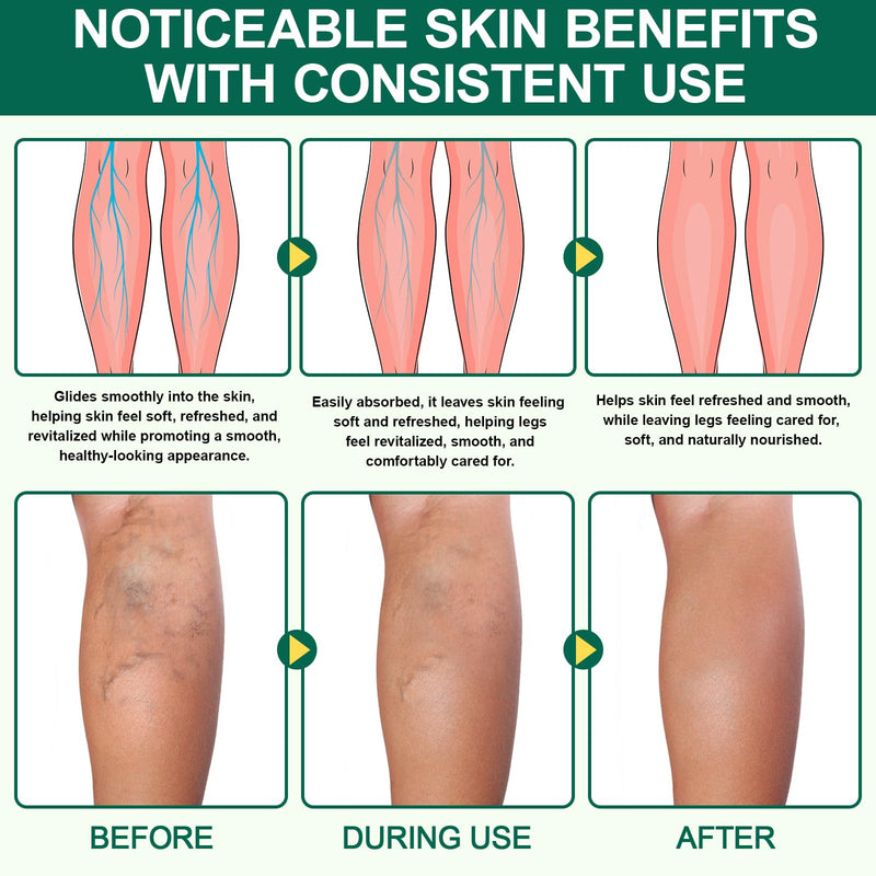 2 Pack Miracle Balm for Swollen Legs, Veins Soothing, Relaxing & Comfortable, Botanical Formula with Calendula for Back, Hands, Feet and Body 1 Ounce (Pack of 2)