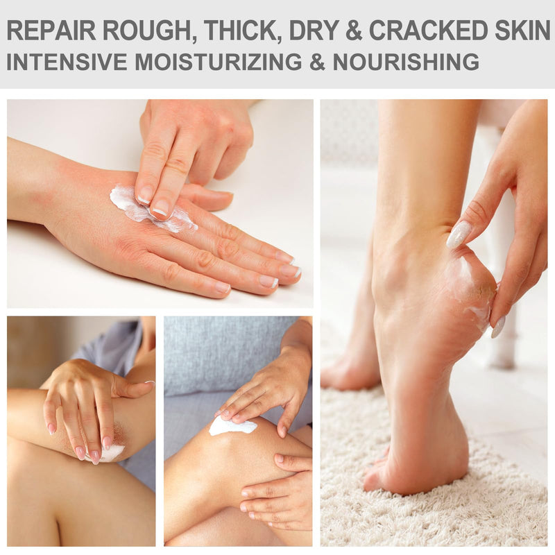 [Australia] - 3 Packs Urea Cream 40 Percent - Foot & Hand Cream, for Dry, Cracked Heels, Feet, Knees, Elbows, and Hands, Callus Remover, Maximum Strength Urea Lotion for Softening and Moisturizing 5.29 Ounce (Pack of 3) 