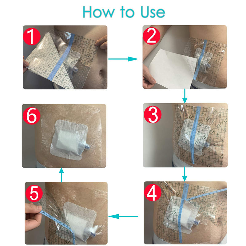 [Australia] - Waterproof Dialysis Catheter Shower Cover 10x12 Inch Protector with Non-Stick Center Pad PICC Line Bandage Patch Dressing Wounds Chest Port PD Peritoneal Accessories (Pack of 14) 10x12 Inch (Pack of 14) 