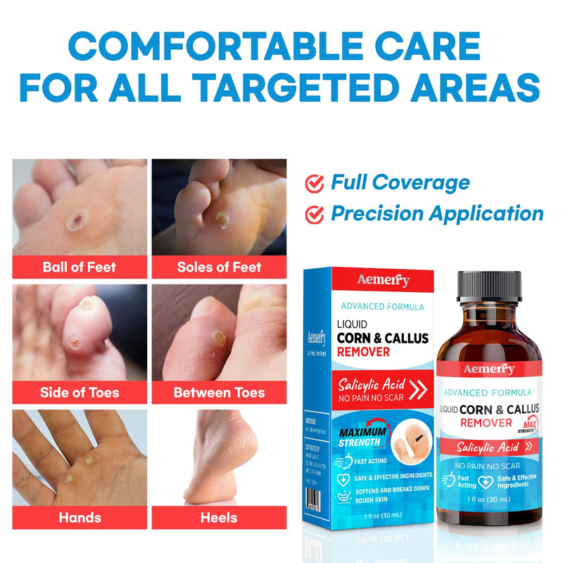 [Australia] - Corn Removers for Toes Foot: Liquid Salicylic Acid 17% Corns Calluses Removal Extra Strength, Fast Acting Corn Remover for Feet Fingers. 30ml 