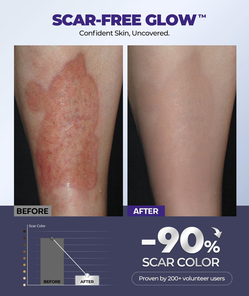 [Australia] - Silicone Scar Cream with 6.7% Active Ingredients, Scar Gel Visible in 2 Weeks, Moisturizing Scar Removal Clinically Show for Surgical, C-Section, Keloid, Acne & Burn Scars, Stretch Mark Cream(55ML) 