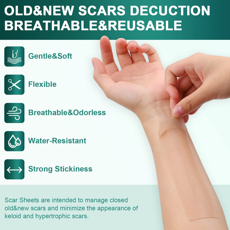 [Australia] - Silicone Scar Sheets,Silicone Scar Tape(1.6"x 120" Roll-3M), Reusable and Effective Scar Removal Sheets, Silicone Scar Removal Sheets for Surgical Scars,Healing Keloid, C-Section, Tummy Tuck 1.6"x 120" Roll 