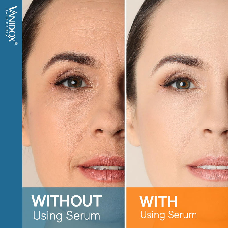 VANIDOX Super Vitamin C Serum for Women Over 70, All-In-One Formula, Made in USA, Hydrates, Firms, Lifts, and Targets Wrinkles, Age Spots, and Fine Lines, Vitamin C Serum (1fl oz x 2) 1 Fl Oz (Pack of 2)