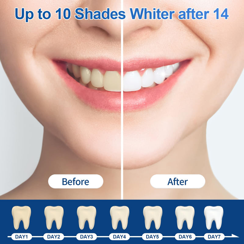 44% Ganencsnc 44% 10-Pack Teeth Whitening Gel Refills - Gentle 44% Carbamide Peroxide Formula - Compatible with Teeth whitening Kit,No Sensitive Teeth Whitener