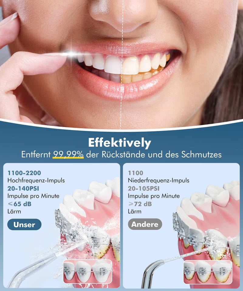 [Australia] - ETROBOT Oral Irrigator Wireless Electric Tooth Cleaner, 2024 Electric Water Flosser - 4 Modes & 5 Nozzles Interdental Space Cleaner, IPX7 Waterproof, Oral Irrigator Test Winner, Dental Irrigator for Oral Care Black 