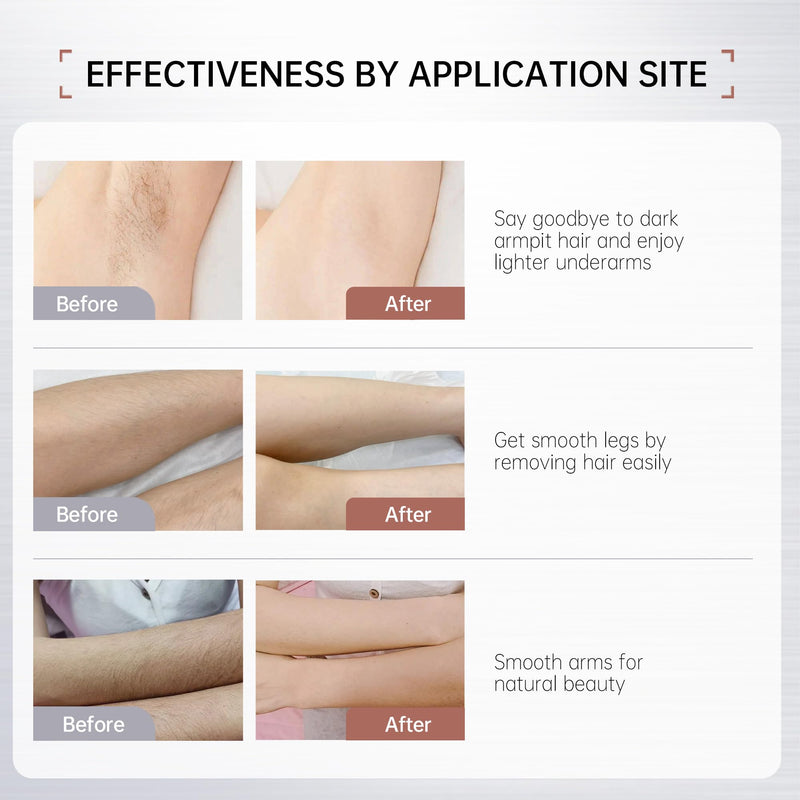 [Australia] - VGO Painless Bikini Gel for Women & Men, Unwanted Hair Removal for All Skin Types, 120ml / 4.06oz 4.06 Fl Oz (Pack of 1) 