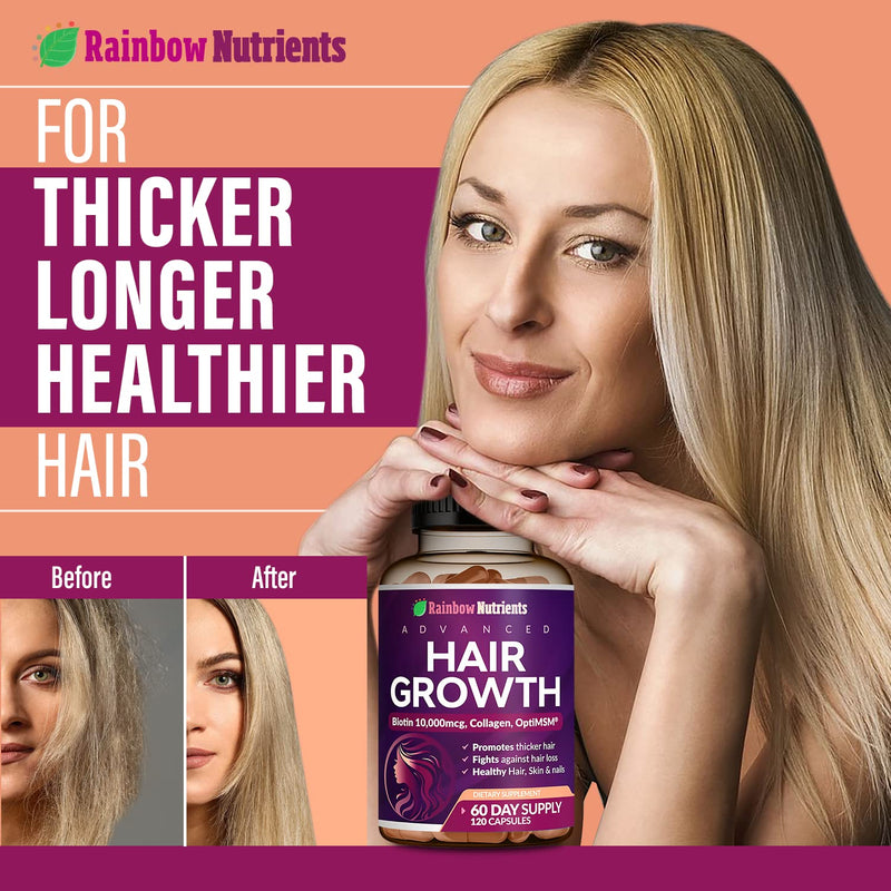Hair Growth Vitamins for Women | Biotin 10,000mcg, Collagen, Patented OptiMSM®, goMCT®, Saw Palmetto | Naturally Supports Stronger & Healthier Hair, Skin and Nails |Non GMO + Made in USA|60 Day Supply 120 Count (Pack of 1)