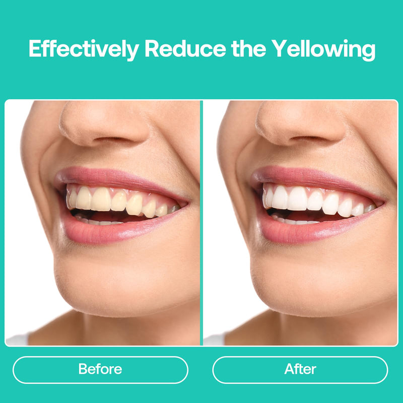 [Australia] - Teeth Whitening Gel Refill, 8 Packs, 35% Carbamide Peroxide Whitening Gel for Trays, Profesional Teeth Bleaching Gel for Fast Result, Work with Teeth Whitening Kit, IMOSTY Whitening Gel (8 x 3ml) 