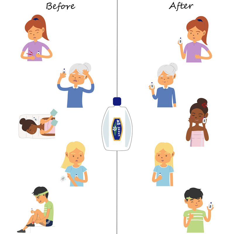 [Australia] - White Flower External Analgesic Balm Oil 10ml/ 0.338fl Oz., Authentic US Import (1 Pack) 