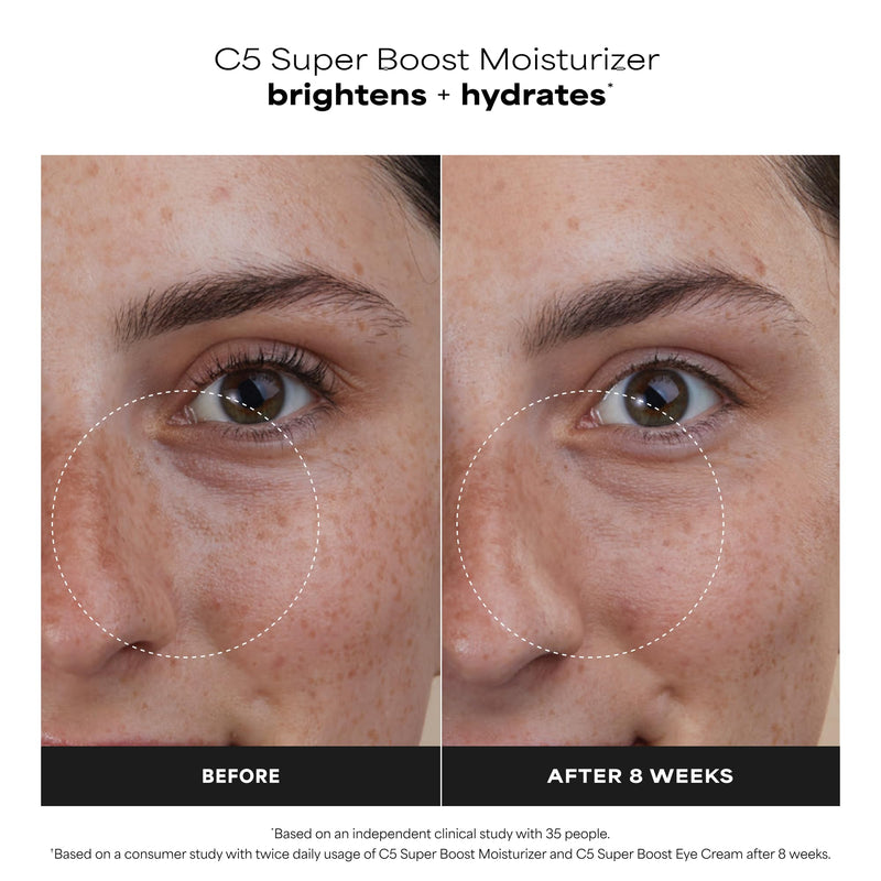 Paula's Choice C5 Super Boost Face Moisturizer with 5% Vitamin C | Daily Face Lotion with Squalane for Discoloration, Uneven Tone, Fine Lines & Breakout-Prone Skin, Fragrance-Free Travel Size - 0.5 Fl Oz