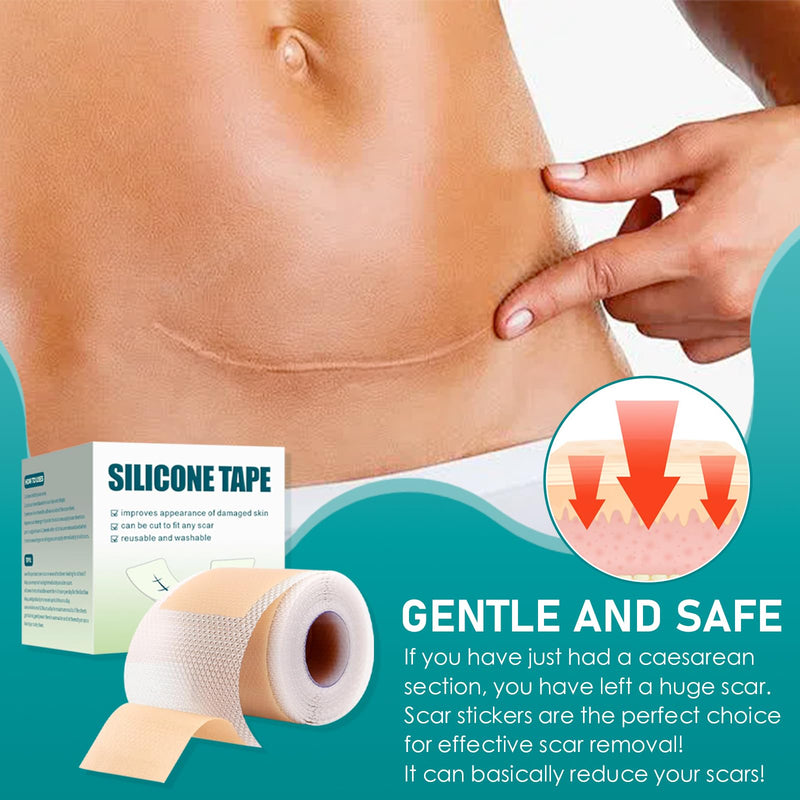 [Australia] - Silicone scar plaster, silicone plaster for scars, silicone scar tape roll, scar roller, surgical scars, silicone scar sheets for visible scar care (4 cm x 300 cm) 