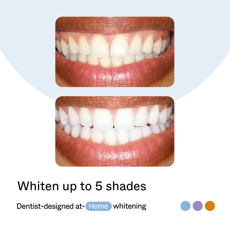 Opalescence GO Home Advanced Teeth Whitening Trays 15% - 6006-T | (4 Treatments) Hydrogen Peroxide PF Whitening Gel Prefilled Trays Kit - Developed by Leaders in Professional Whitening Mint 15 1 Count (Pack of 4)