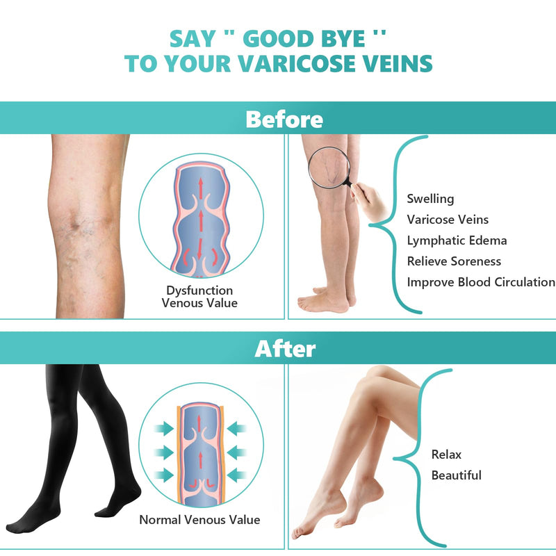 [Australia] - Compression Pantyhose Stockings for Women Men, 20-30 mmHg Medical Graduated Support Opaque Closed Toe Hose Tights for Swelling, Edema Varicose Veins Waist High Compression Stockings Black Medium 