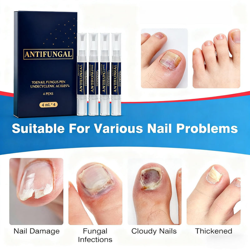 Toenail Fungi Treatment Extra Strength & Fungi Nail Pen - 4PC Fungi Nail Pen Repair for Damaged Nails,Targeted Solution for Nail Health Concerns (Athletes Ideal), 4ml/0.14FLOZ -2 Blue-3