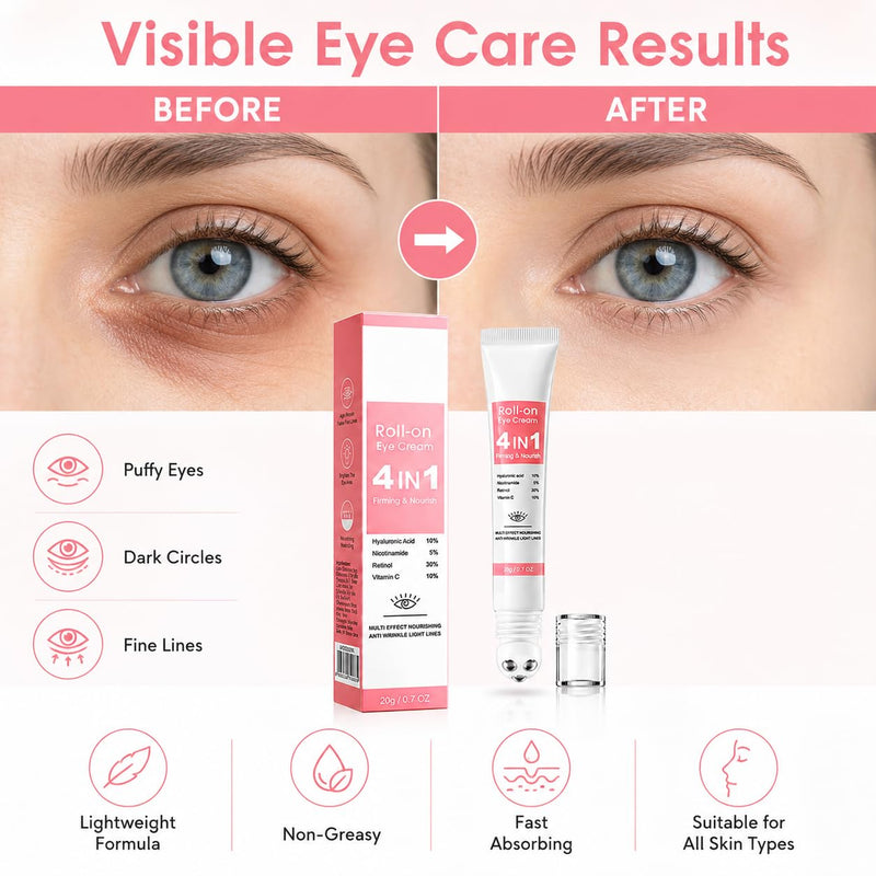 Retinol Eye Cream for Puffiness & Dark Circles, Under Eye Cream with Hyaluronic Acid, Nicotinamide & Vitamin C, Eye Puffiness Reducer and Eye Bag Cream with 360° Eye Roller for Women & Men